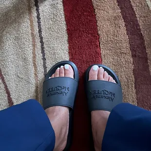 Day before: I had small clips on the tips. But still had plenty of space that I didn't have to go beyond the nail beds.