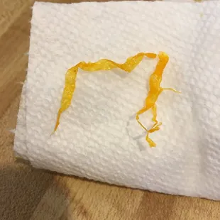 This is the plastic that was in the food.