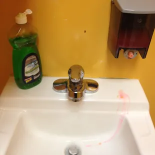 Dish detergent to wash your hands instead of hand soap