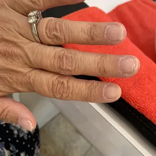 A finished side after removing nails after a horrible new set. Most unprofessional place I have ever experienced.