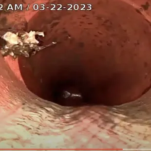 sewer scope saved me from a potential waste of money from this bad house I was about to buy. See the roots already in line