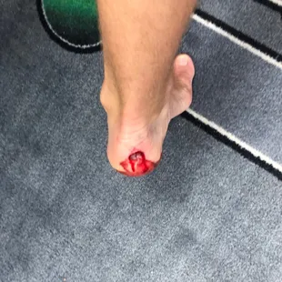 a person&apos;s foot with a blood splatter on it