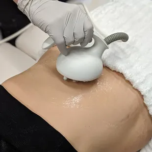 Body Contouring