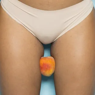 Women&apos;s Health Services
 for vaginal tightening and 
 incontinence.