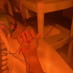 Accupuncture needles and electrodes