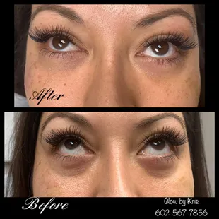 Bright &amp; Beautiful Under Eye Procedure!
