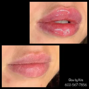 Lips!!