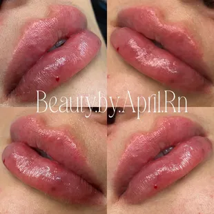 Luscious lips!