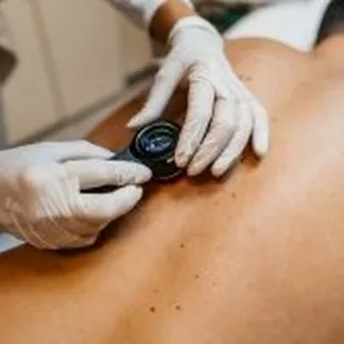 Advanced Dermatology &amp; Skin Cancer Specialists - doc scanning skin on man back