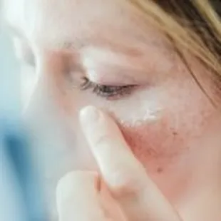 Advanced Dermatology &amp; Skin Cancer Specialists - woman placing cream on eye