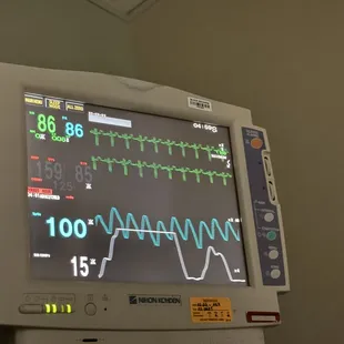 See this?  The damn thing was not even correctly hooked up to my body!  Nice false read, aye?  Really nice.