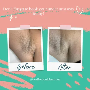 Before and After Under arm wax