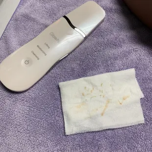 Extractions are my favorite!