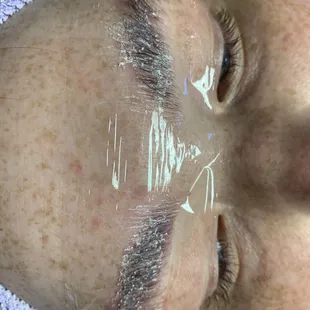 Brow lamination in progress