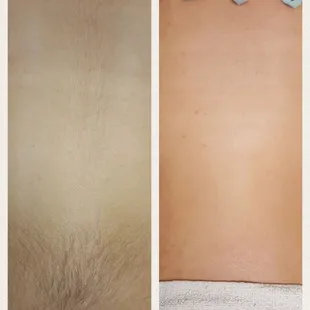 Back wax before and after