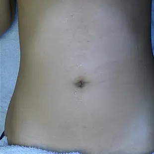 Before and after Stomach Wax