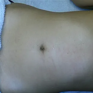 Before and after stomach wax