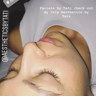 Beautiful flawless skin after Enzyme facials by Tati