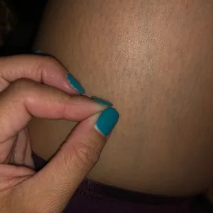 Nails lifting getting caught in my hair