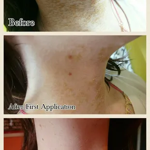 Our 825 Serum completely healed this clients fungal condition in only 2 days!