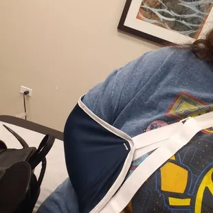 Fractured right shoulder