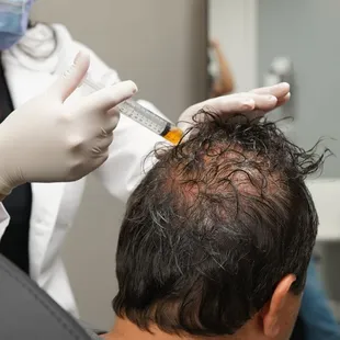 PRP Hair Loss Treatment