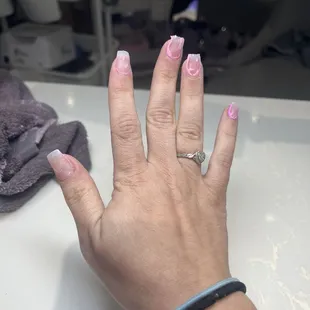 Thick ugly not coffin shaped nails