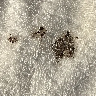 The gross on my towel.