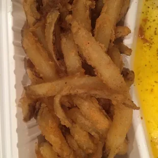 Eww! Full of Grease. F*cking Garbage! Don't eat here. This is Super Bowl 17" night.