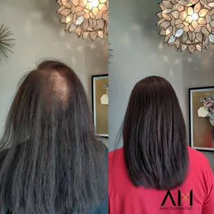 MicroLines extensions.