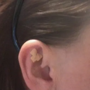 Ear seeds - a small black sesame seed is placed under each piece of tape on the front and back of my ear for acupressure.