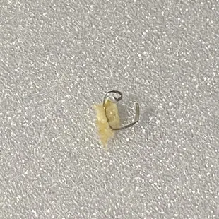 Metal in the egg.