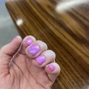 Pinky nail is so cut up