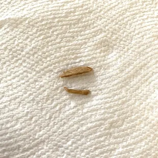 Found these pieces of wood in my Quebecer Poutine. Don't think I'll be ordering that for a while :(