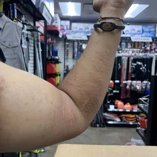 a man&apos;s arm showing off his muscles