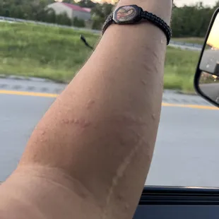a person&apos;s arm with a watch on it