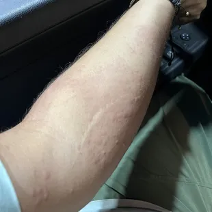 a man&apos;s arm resting on the dashboard of a car