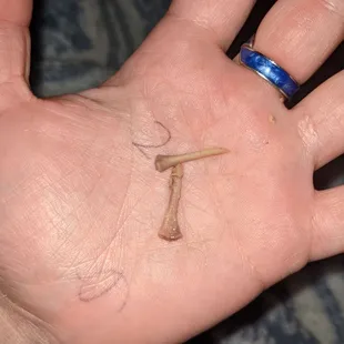 Chicken bones