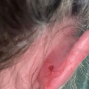 Piercing embedded in ear