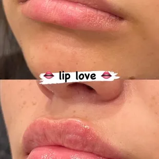 Love these lips