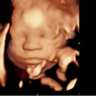 Ultrasound of our love bug