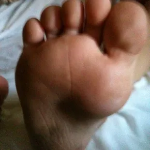 my daughter's foot after walking on the floor