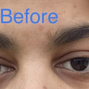 Before: eyebrows are 4 months of bad