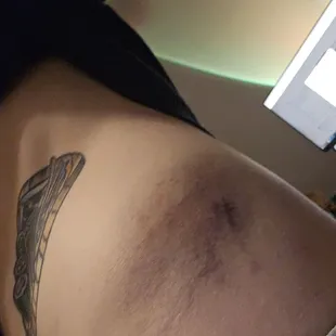 This attacked occurred outside of the venue, off property, by an employee of Soundstage