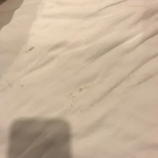 Stained bed sheets.