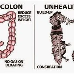 Healthy colon VS Unhealthy colon