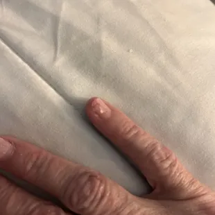 Pinky nail sliced in halve