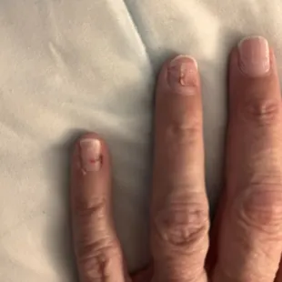 After they were ripped off