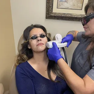 IPL Photofacial
