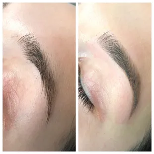 Another amazing before and after